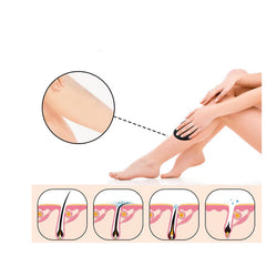 Dispozitiv de Epilare At Performance, prin Frecare cu Cristale, Pentru Indepartarea Parului si Exfoliere, Reutilizabil, Fara Durere